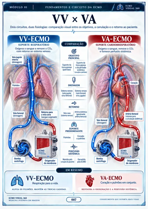 VV-ECMO